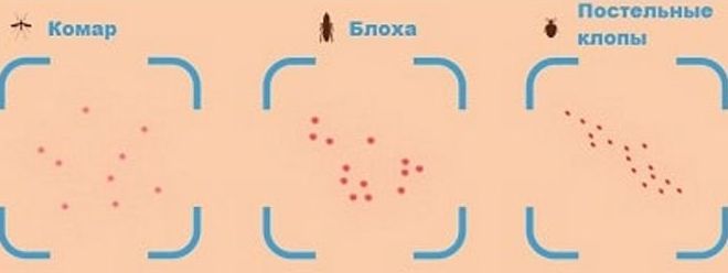 укусы бельевых клопов укусы бельевых клопов
