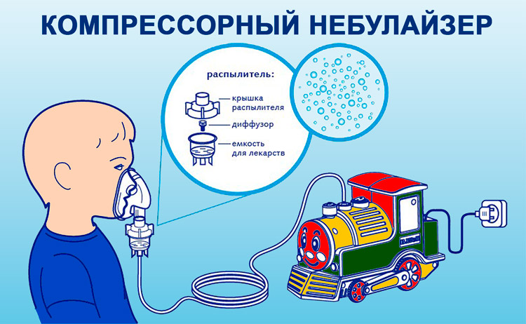 Ингаляции Небулайзер