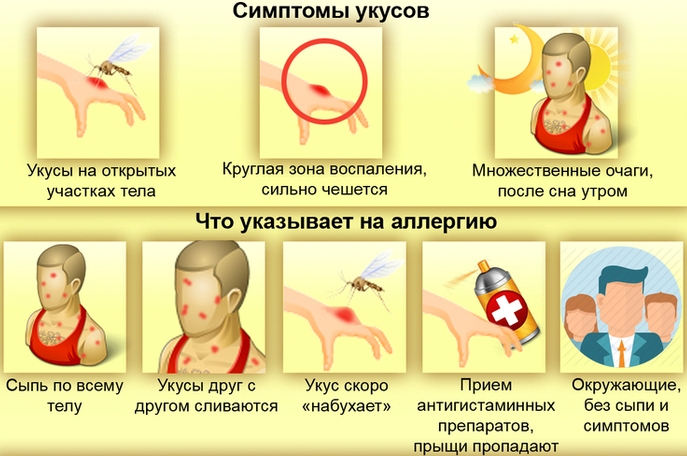 Может ли быть аллергия на укусы комаров