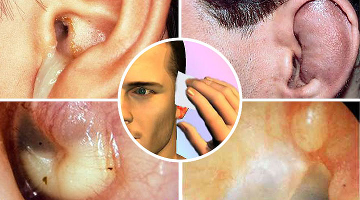 Провокаторы катаральных процессов Инфекционные заболевания