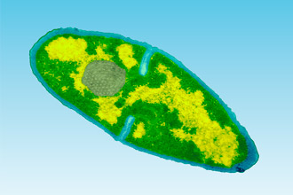 Дифтерийная бактерия Дифтерийная палочка