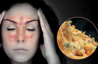 Причиной фронтита становится не долеченное инфекционное заболевание Причины фронтита