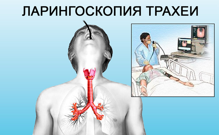 Ларингоскопия Проведение ларингоскопии