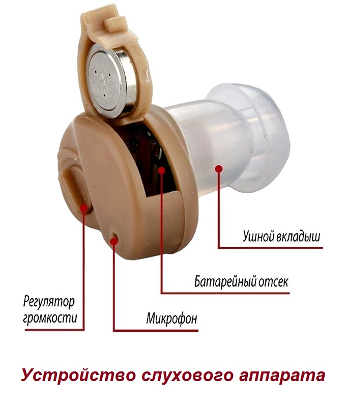 Основной костяк слухового аппарата остается базовым уже более 100 лет Устройство слухового аппарата