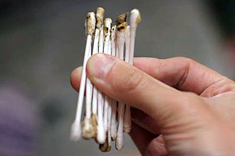 Черные выделения Черные выделения